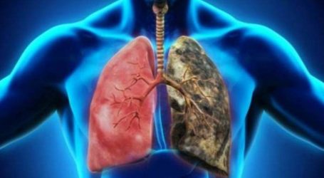 دراسة تكشف لغز إصابة غير المدخنين بمرض رئوي مزمن
