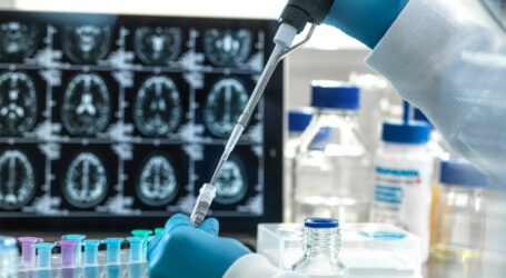 “اختراق علمي”… علاج جديد لألزهايمر يبطئ تدمير الدماغ